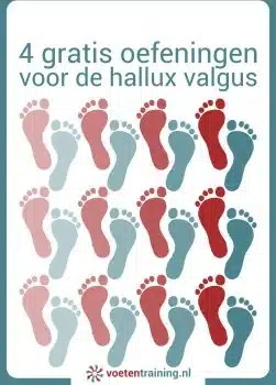 Hallux Valgus